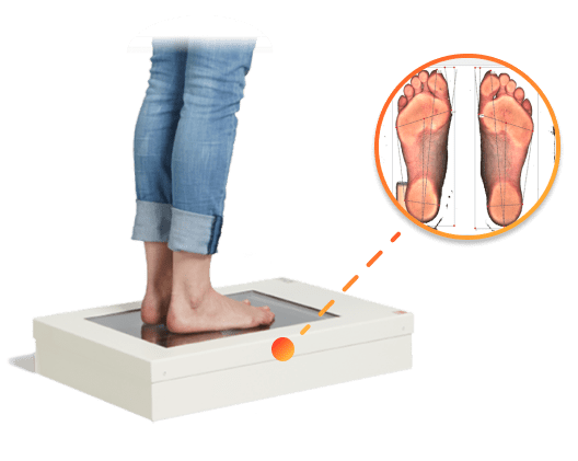 Диагностика стоп CoreStep