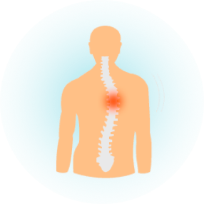Искривление позвоночника