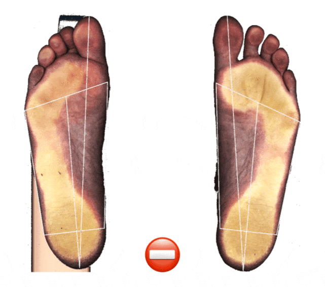 Результат Валентины